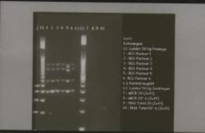 Gambar 13.1 Hasil Multiplex PCR Mycobacterium (Jeffeta Pradeko Putra dkk, 2014) 