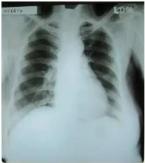 Foto Thorax (14 Juni 2011)