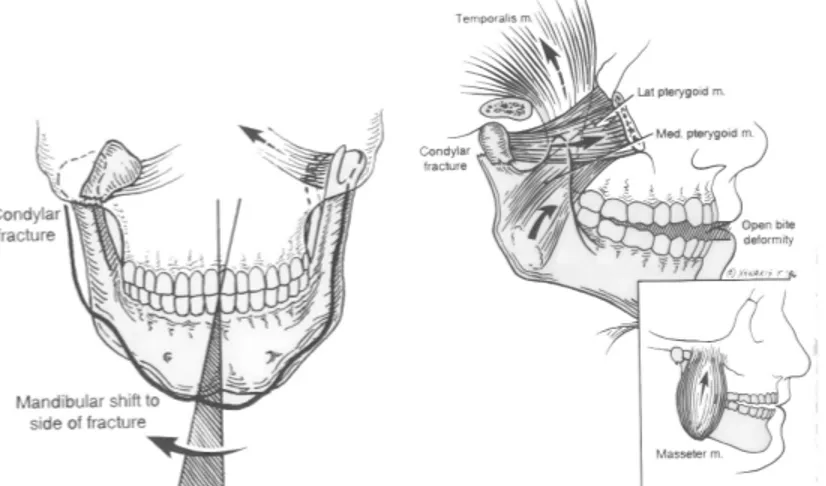 Gambar 2. Kiri: pergerakan normal mandibula. Kanan: pergerakan abnormal mandibula (Schultz, 1988)