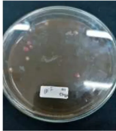 Gambar  3   Penampakan koloni bakteri berwarna hijau metalik pada media EMBA   (A) dari atas cawan Petri, (B) dari bawah cawan petri