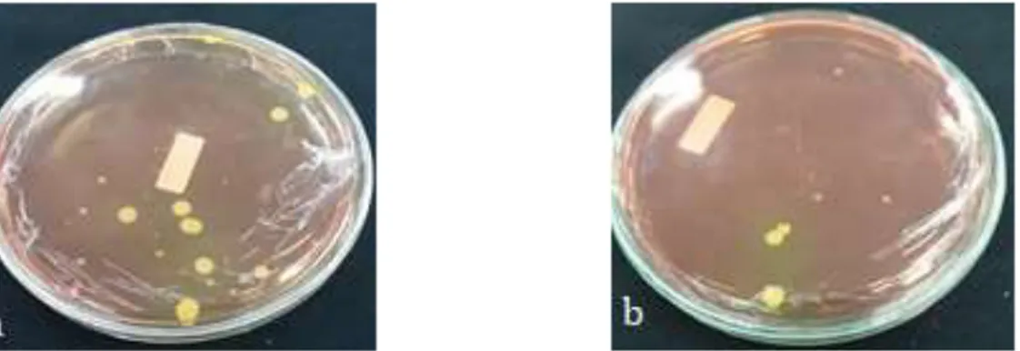 Gambar 2   Hasil Pewarnaan Gram Staphylococcus aureus dari sampel A1 dan B1                              yang berusia 12 bulan