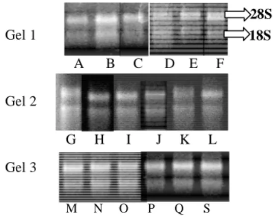 Gambar  9    Elektroforegram  RNA  kulit  batang  hasil isolasi. A, F, G, H, O (d2); B,  I,  P  (d4);  C,  J,  Q  (d6);  N  (d4/E2); 
