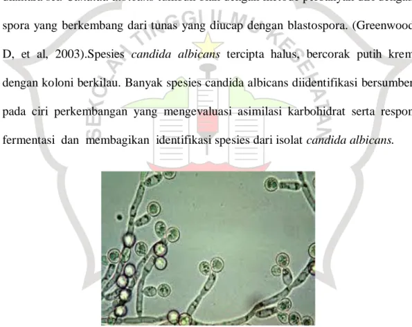 Gambar 2.2 Candida albicans  2.6.3. Patogenesis candida albicans. 