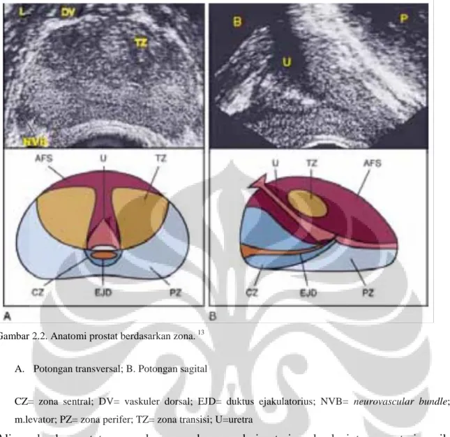 Gambar 2.2. Anatomi prostat berdasarkan zona.  13