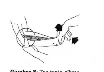 Gambar 8: Tes tenis elbow 