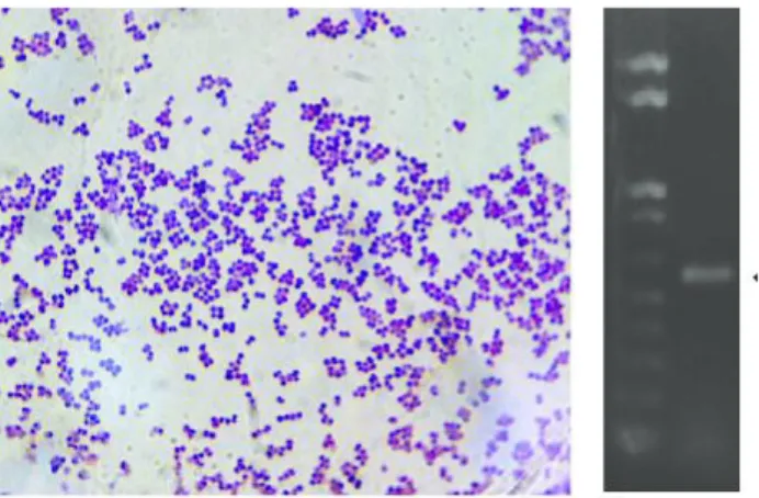 Gambar 10. Staphylococcus epidermidis (Sumber: researchgate.net)  Staphylococcus  epidermidis  merupakan  bakteri  yang  bersifat  oportunistik  (menyerang  individu  dengan  sistem  kekebalan  tubuh  yang  lemah)