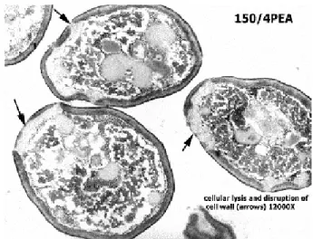 Gambar 3.  Kebocoran dinding sel dan membran plasma Saccharomyces           cerevisiae akibat perlakuan dengan detergen (Y-PER) pembesaran            12 000X, (Nowicki dan Liermann  2002) 