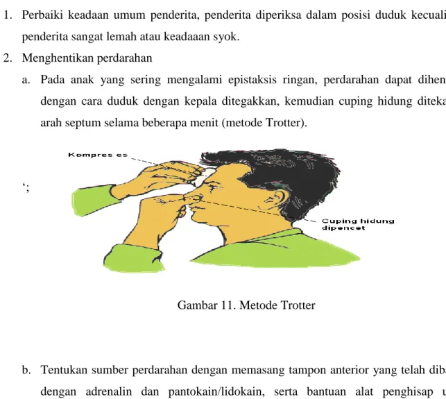 Gambar 11. Metode Trotter 