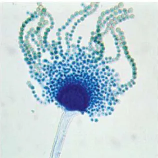 Gambar 2. Tampilan mikroskopis dari Aspergillus flavus  