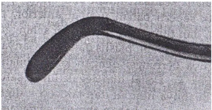 Gambar : Plastis datar 