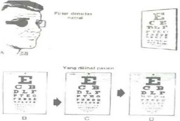 Gambar 4.  Tes Filter Densitas Netral 1