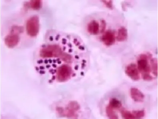 Gambar 1. Gambaran Diplococcus Gram Negatif