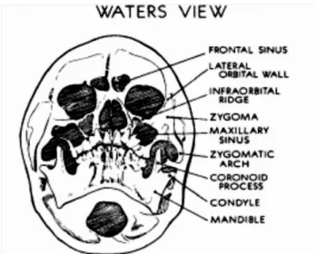 Gambar 11. Pemetaan struktur wajah pada foto radiologis posisi Waters atau  Waters terbalik