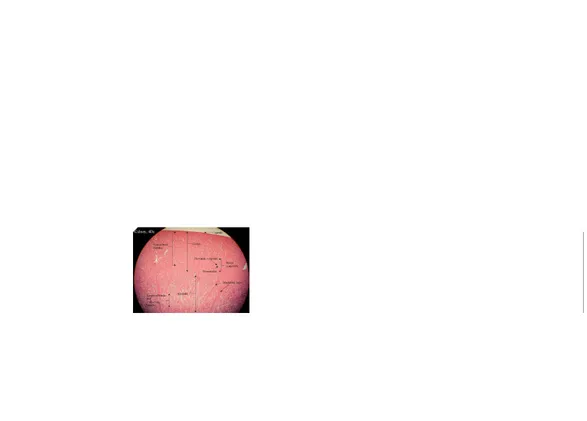 Gambar 3. Penampang Ginjal Gambar 3. Penampang Ginjal  Sinus renalis