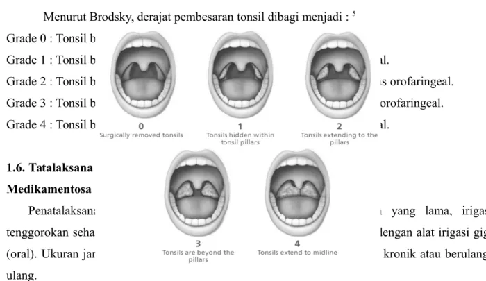 Gambar 3. Derajat pembesaran tonsil