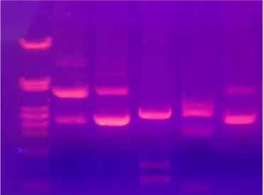 Gambar 2.4.2  Pita DNA hasil elektroforesis di bawah sinar UV (Anonim, 2006) 