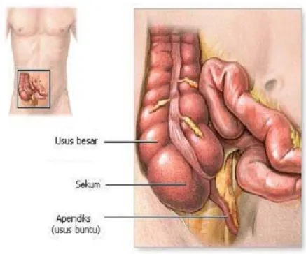 Gambar 1. Posisi anatomi apendiks
