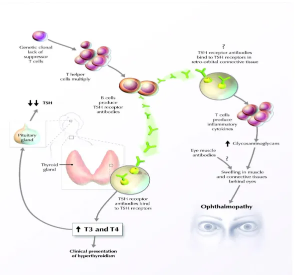 Gambar 1: Patogenesis Penyakit Graves  