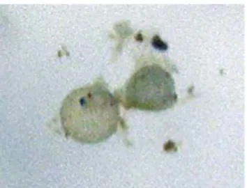 Gambar 15. Acaulospora sp.  Gambar 16. Sporiferous  Saccule pada Acaulospora sp. 