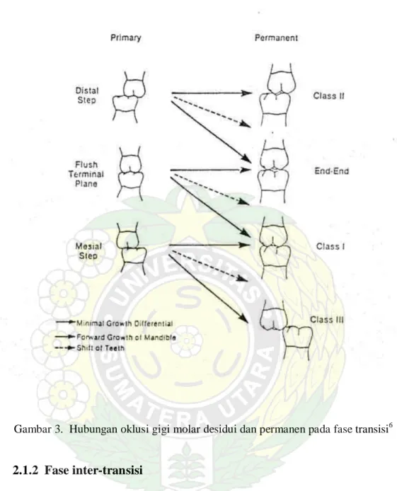 Gambar 3.  Hubungan oklusi gigi molar desidui dan permanen pada fase transisi 6 