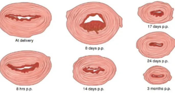 Gambar 1 potongan melintang uterus setinggi tempat pelekatan plasenta yang berinvolusi pada waktu yang berbeda – beda setlah pelahiran 1