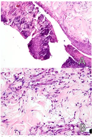 Gambar 1.  Histologi kulit tikus pada kelompok 1      HE-100X (A); HE-400X (B) 