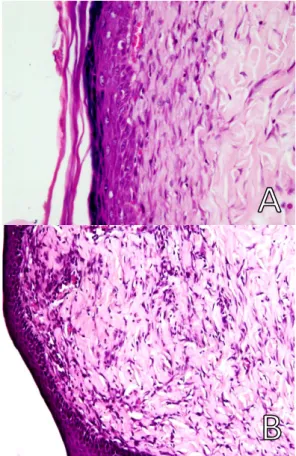 Gambar 2.  Histologi kulit tikus pada kelompok 2              HE-100X (A); HE-400X (B) 