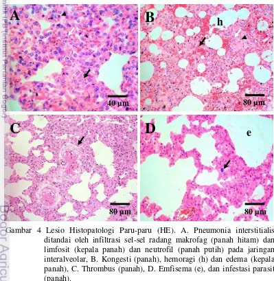 Gambar 4 Lesio Histopatologi Paru-paru (HE). A. Pneumonia interstitialis  