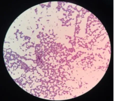Gambar 2 Hasil Pewarnaan Gram Bakteri Enterococcus faecalis 