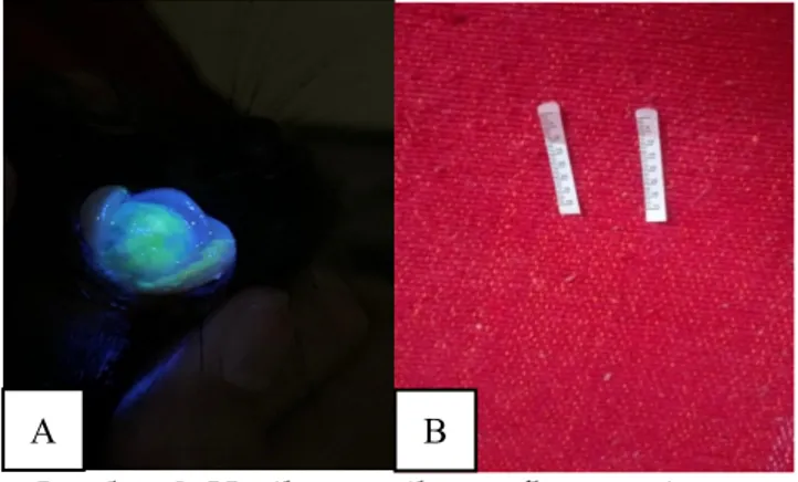 Gambar 3. Hasil pemeriksaan fluorescein  test (A), dan schirmer test (B)  