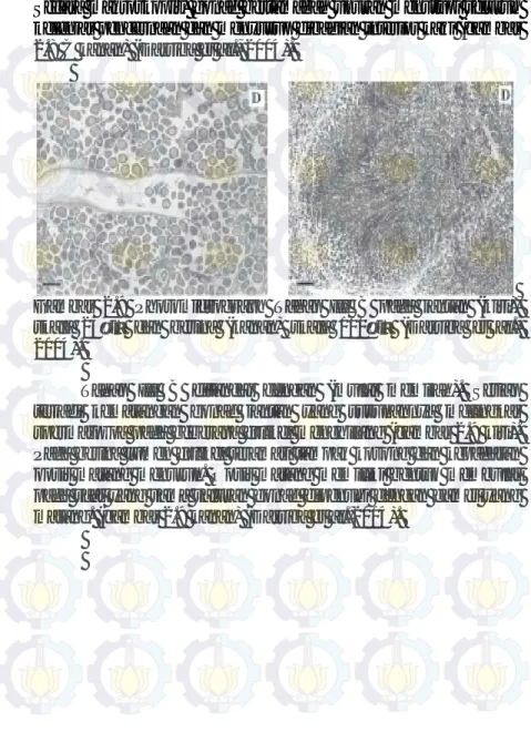 Gambar  2.9  Photomicrograph  Tahap  III  B  pada  jantan  (kiri),  skala  25µm  dan  betina  (kanan)  skala  100µm  (Darriba  et  al.,  2004)