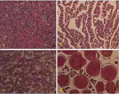 Gambar 1. Pengamatan secara histologi perkembangan gonad calon induk yang diberi pakan  prematurasi