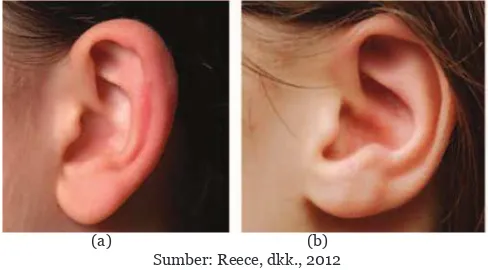 Gambar 7.7  Tipe Perlekatan Cuping Telinga (a) Terpisah (Memiliki Gen GG atau Gg), (b) Melekat (Memiliki Gen gg).
