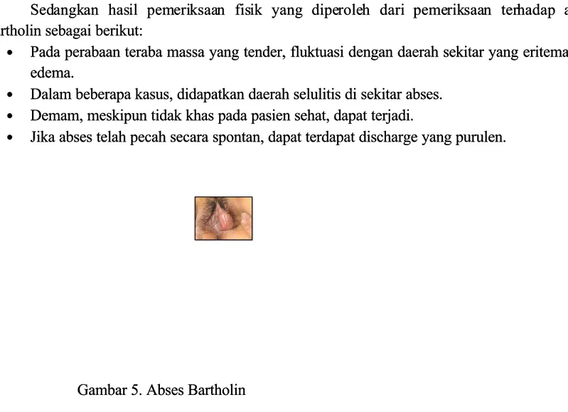 Gambar 5. Abses BartholinGambar 5. Abses Bartholin