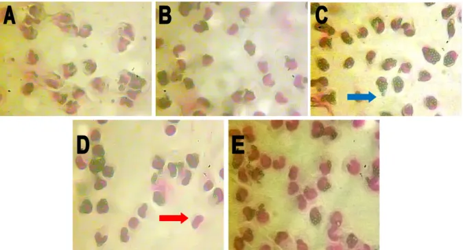 Gambar 2. Kemampuan fagositosis makrofag akibat perlakuan fraksi etil asetat ekstrak etanol  akar pasak bumi dilihat dengan mikroskop cahaya dengan perbesaran 400X,  a