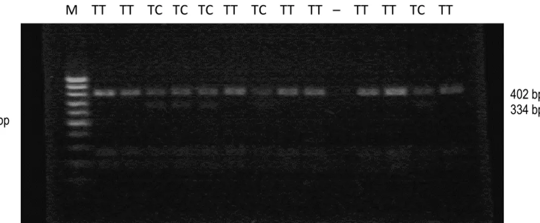 Gambar 5. Profil RLFP varian T-344C gen STOX-1 dengan enzim HaeIII pada kelompok kasus