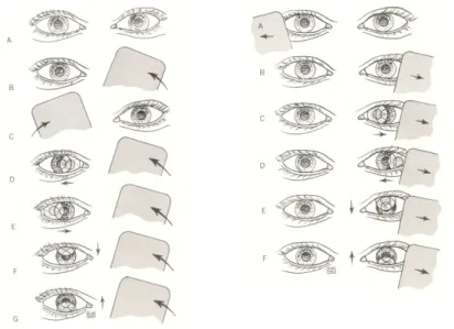 Gambar  13. Cover – Uncover Test