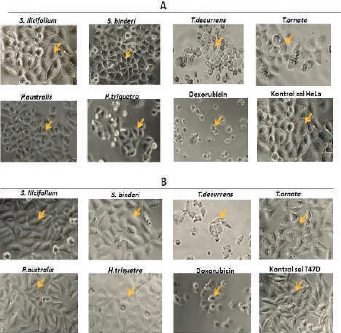 Gambar 3.  Efek ekstrak rumput laut coklat (30 μg/ml) terhadap morfologi sel HeLa (A) dan T47D (B).