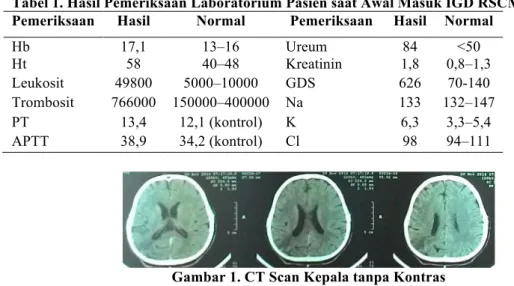 Gambar 1. CT Scan Kepala tanpa Kontras 