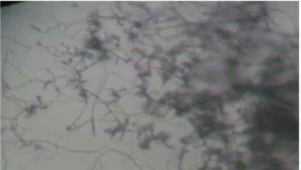 Gambar 5. Morfologis  aeria myselium pada medium SNA  yang berumur 7 hari (400x perbesaran)