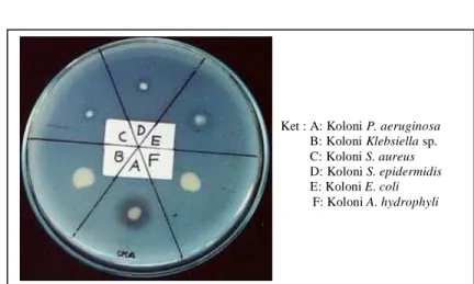 Gambar 2. Zona bening yang dibentuk akibat aktivitas  protease bakteri patogen 