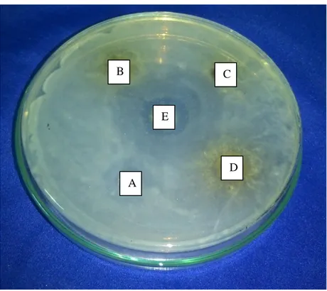 Gambar  1  .  Hasil  Pengamatan  Daerah  Zona  hambatan  Ekstrak  Rimpang  Temu  Putri  (Curcuma petiolata Roxb)Terhadap Pertumbuhan Staphylococcus aureus 