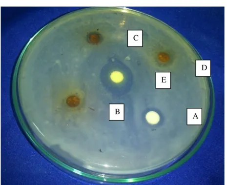 Gambar  3.  Diameter  zona  hambatan  (mm)  pemberian  ekstrak  Rimpang  temu  putri  terhadap Staphylococcus aureusdan Eschericia coli 