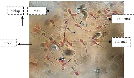 Gambar 1. Kualitas spermatozoa cauda epididimis sapi peranakan simmentalabnormal