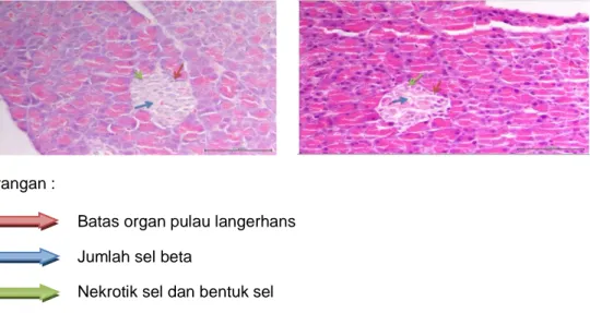 Gambar 4   Histopatologi pankreas tikus kontrol Fraksi N-Heksan perbesaran 400x dengan  pewarnaan H&amp;E (skor 2, 3) 