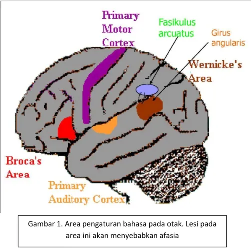 Gambar 1. Area pengaturan bahasa pada otak. Lesi pada  area ini akan menyebabkan afasia 
