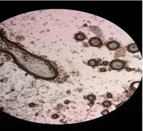 Gambar 4.2 Struktur mikroskopis   simplisia daun pirdot 