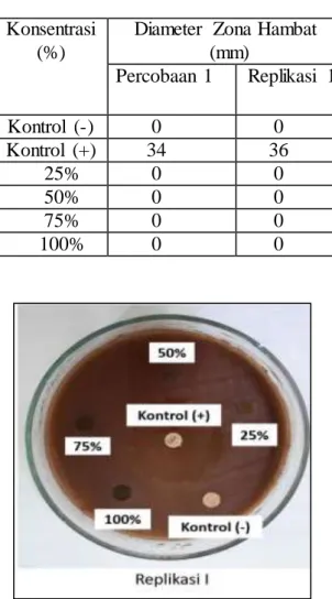 Gambar  1.  Hasil  uji  daya  hambat  ekstrak  getah  tanaman  jarak  pagar  (Jatropha  curcus  L)  terhadap  Streptococcus  mutans  dengan  metode  difusi  cakram  Kirby Bauer