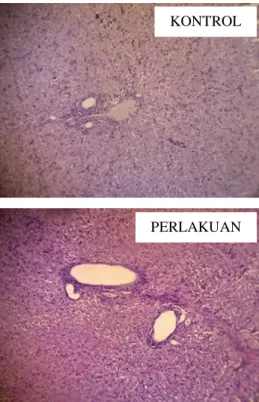 Gambar  1.    Gambaran  histopatologi  hepar  pada  kelompok  kontrol  dan  perlakuan  yang  dipapar  artemisinin  berulang  yang  mengalami  portal  inflamasi  tertinggi