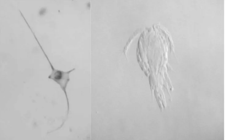 Gambar  2.  Salah  satu  jenis  Ceratium  spp  (fitoplankton)  dan  kopepod,  Cyclops  sp